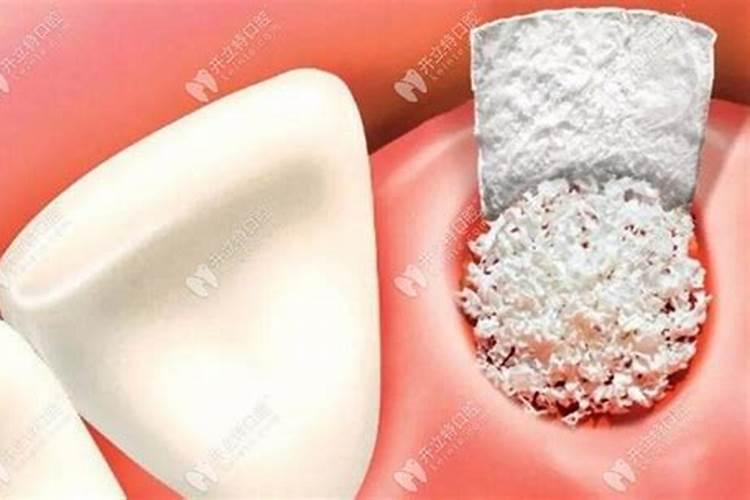 骨粉的正确施肥方法