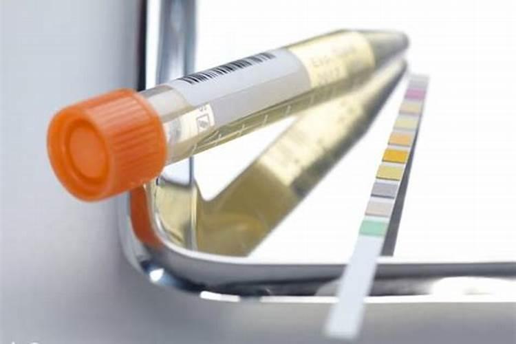 尿素和氮肥有什么区别