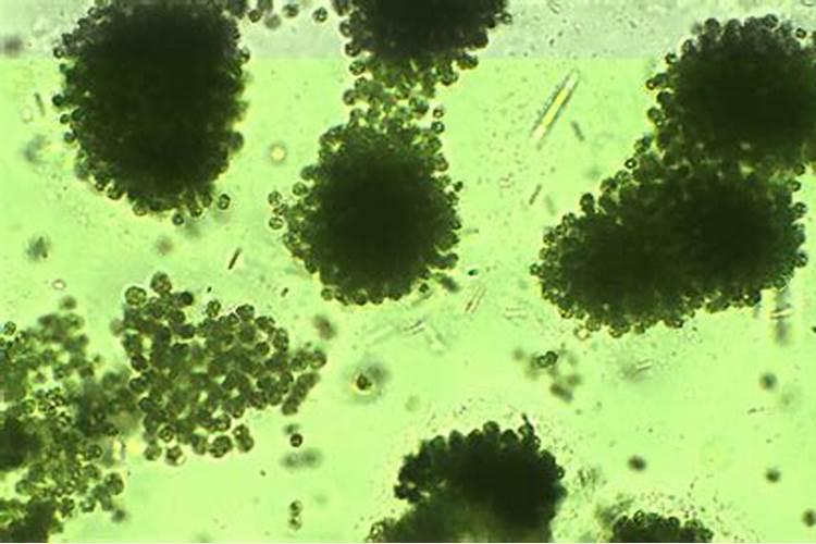 单细胞铜绿微囊藻与绿藻区别