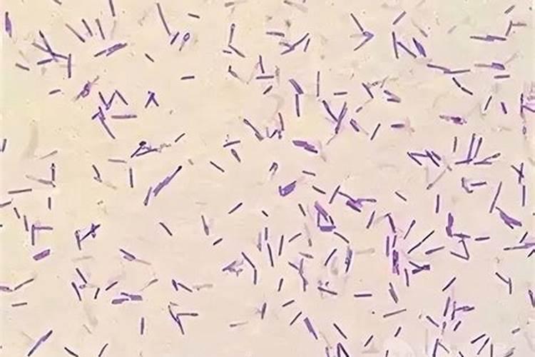 擦亮双眼,防忽悠!一篇文章彻底弄懂真假腐殖酸