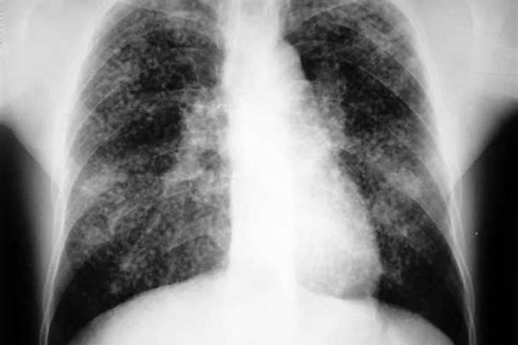 月季花浇了硫酸亚铁和多久可以施肥