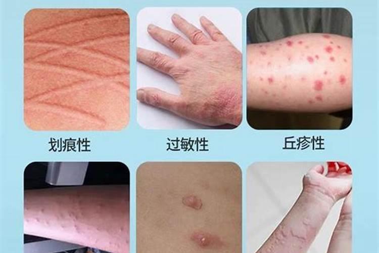 自制鱼蛋白有氨气怎么办呢