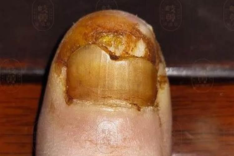 硫酸钾是什么肥料 硫酸钾和氯化钾的区别