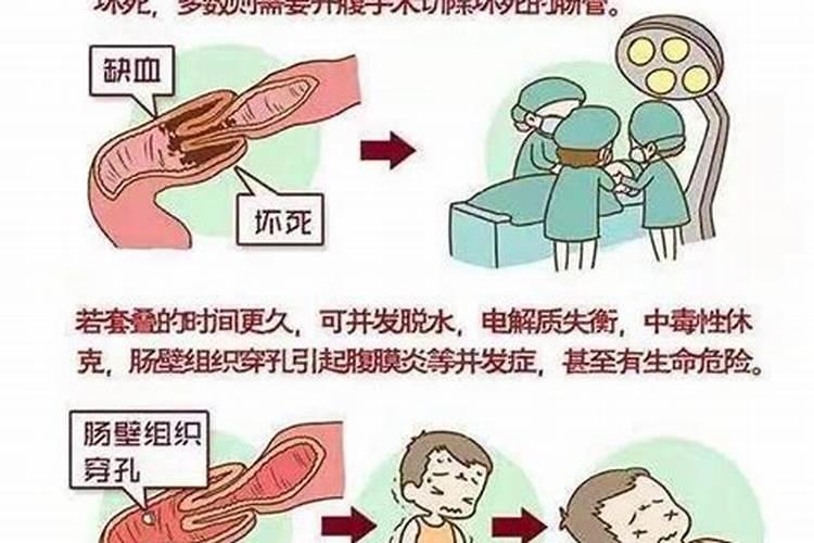 有什么办法能让大便快速软化