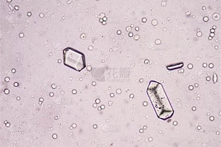 在家怎样自制磷钾肥呢