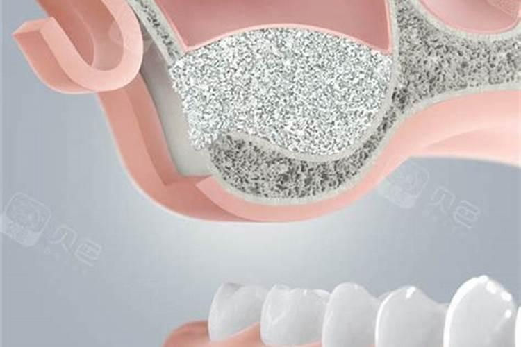 这盆沙漠玫瑰花是舍品种？谢谢