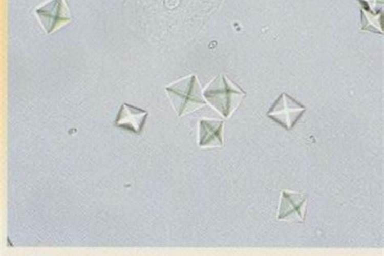 西梅干长了密密麻麻晶体是什么