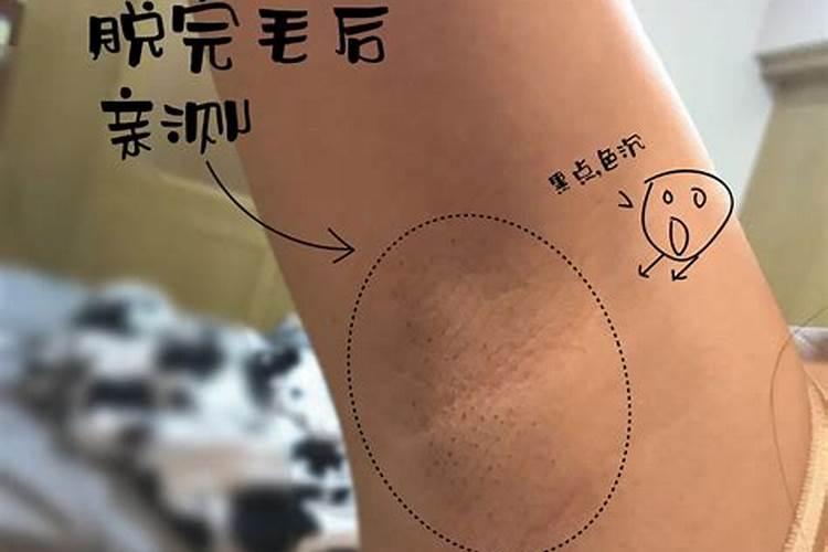 柠檬坐果了需要施什么肥