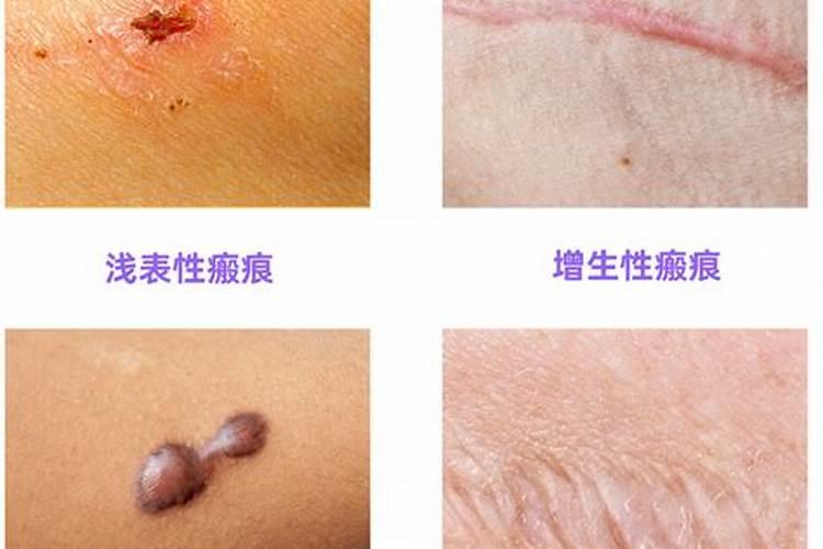 怎么施肥能让结的果子又大又好？