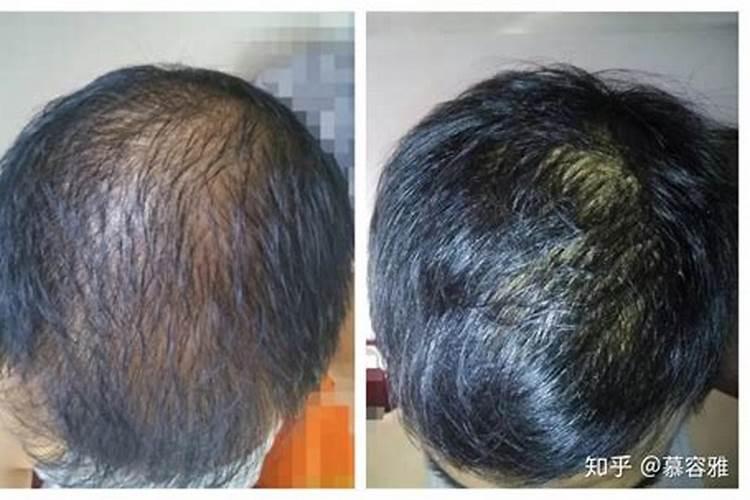 尿素多久施肥一次