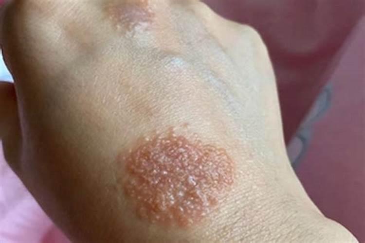 花生不同生长阶段的叶面肥使用技巧 花生应该怎么施肥