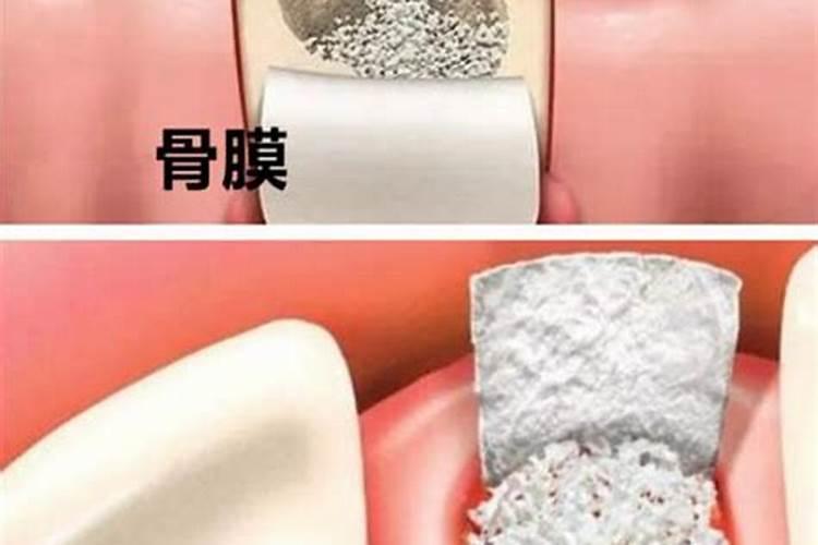 大棚蔬菜能用骨粉高钙肥吗