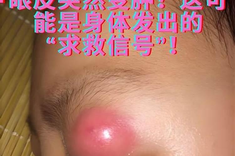 双眼皮肿了什么原因