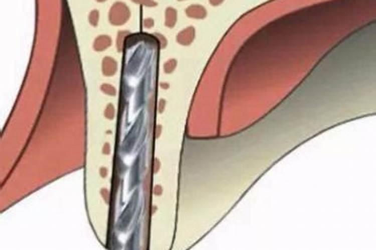 大蒜生根肥料用哪种的效果好？矿源黄腐酸钾含腐殖酸水溶肥？