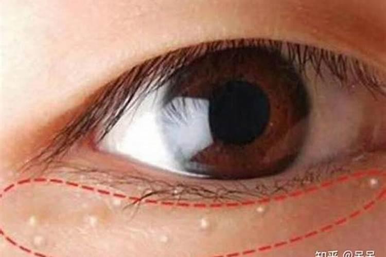 小白圆粒的化肥是什么肥？