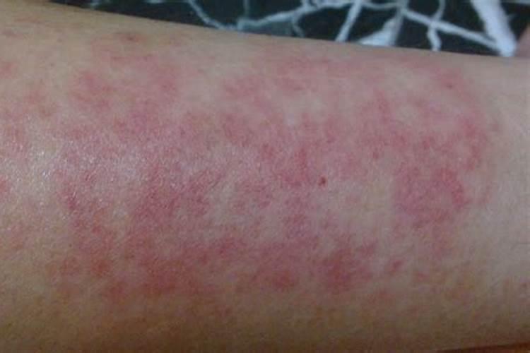 化肥散发的刺鼻味道有毒吗