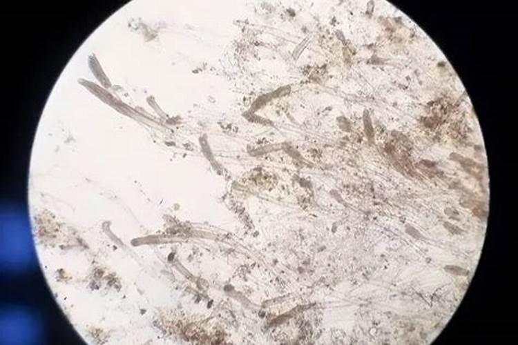 鱼缸里有白色絮状物