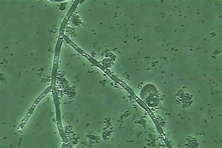 鱼缸壁上有白色絮状物