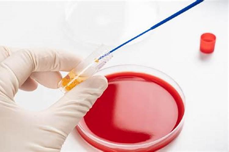 虾塘肥水用红糖一亩要多少,肥水可以用复合肥吗