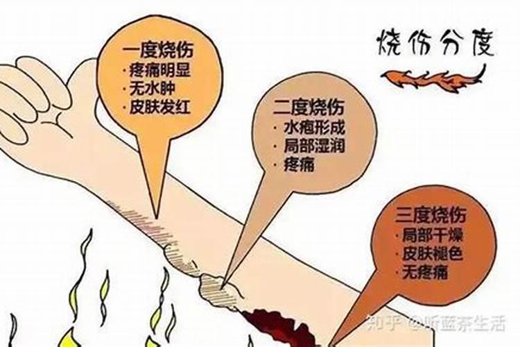 核桃树化肥过量烧叶子怎么办？