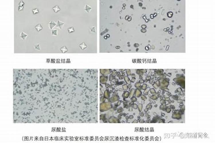 花生肥料最佳配方复合肥