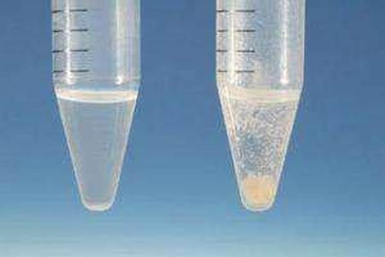 茴香的生长期管理