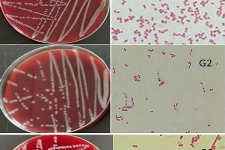 观叶植物用什么叶面肥,怎么施肥