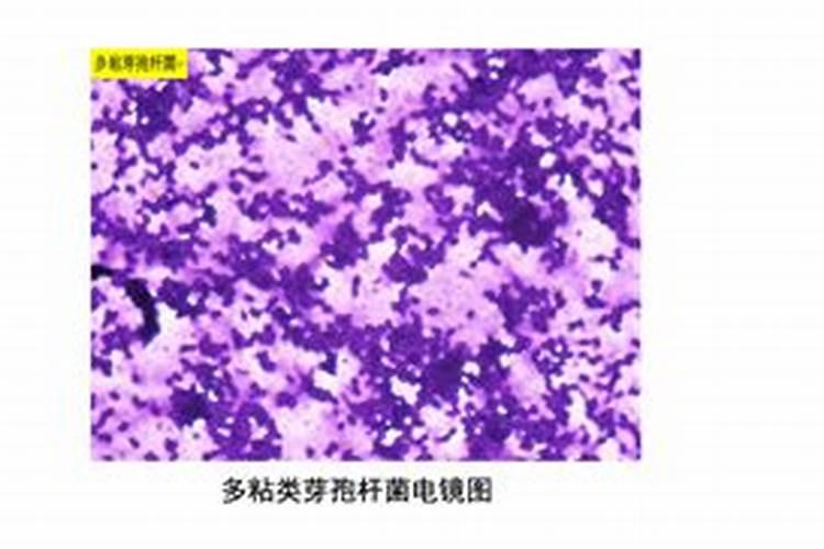百香果浇什么肥料合适