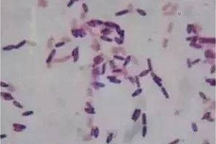 生物肥和芽孢杆菌可以一起下吗