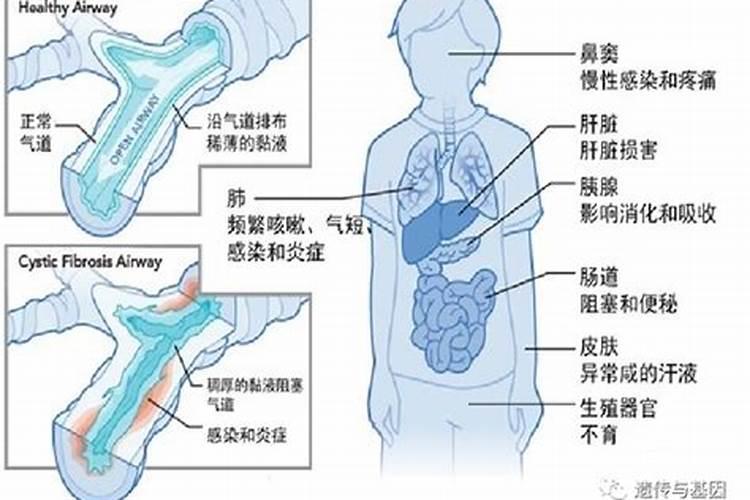 水俣病的特异性体征及其他临床症状