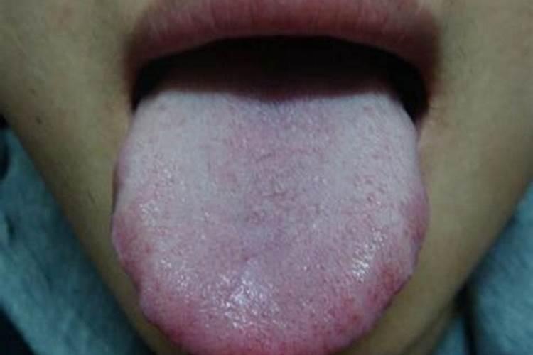 种植枣树时,枣树开花期应该采取怎样的措施进行管理？