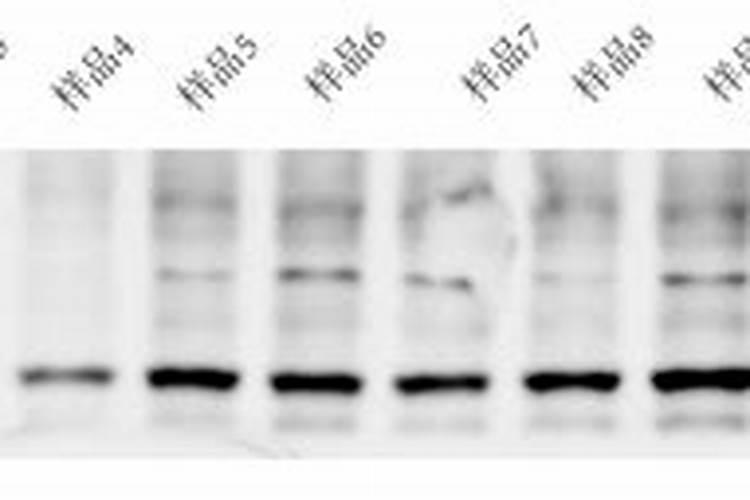 阳台种西瓜的好方法 阳台种西瓜如何进行肥水管理