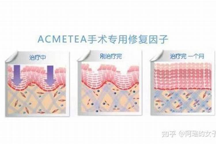 土豆的需肥规律是什么？如何正确施肥？