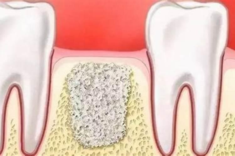 骨粉肥料怎么施肥最好