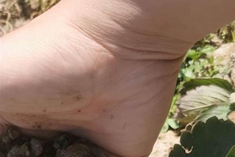 骨粒和骨粉哪个养花好