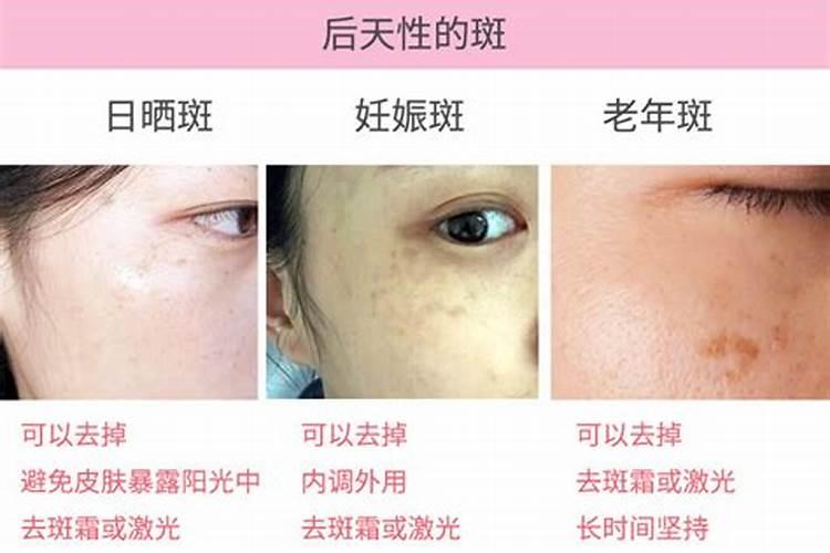 维生素E外用祛斑该怎么用