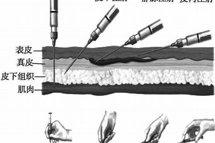 静脉注射为什么不可以加入抑菌剂