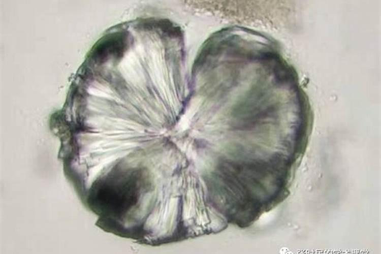 芦笋放沟底肥用那种肥料最好