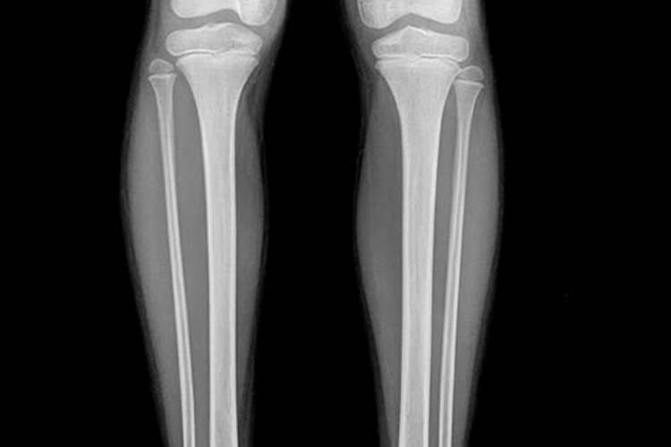 家用化肥哪个是磷肥
