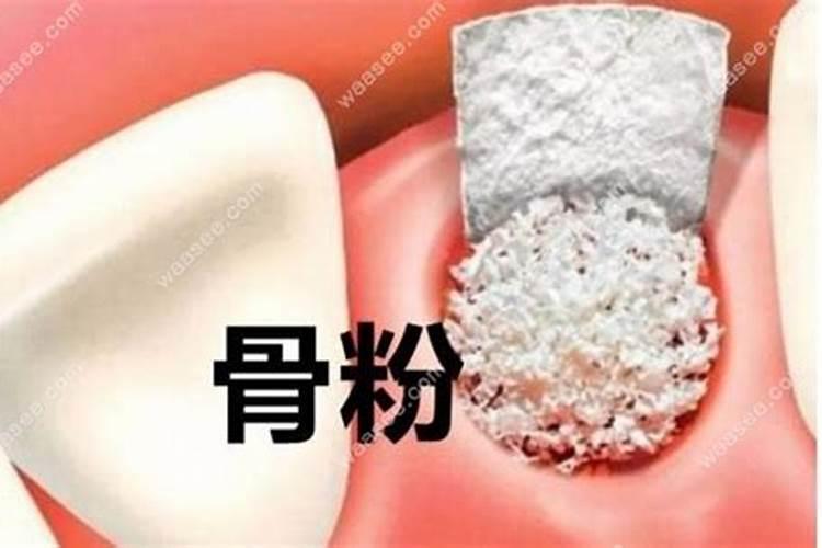 骨粉是什么肥料？