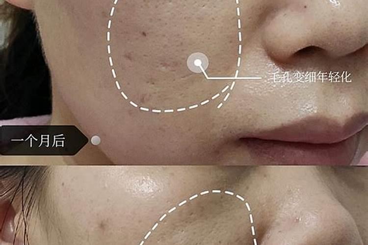 花生需要打几遍芸苔素