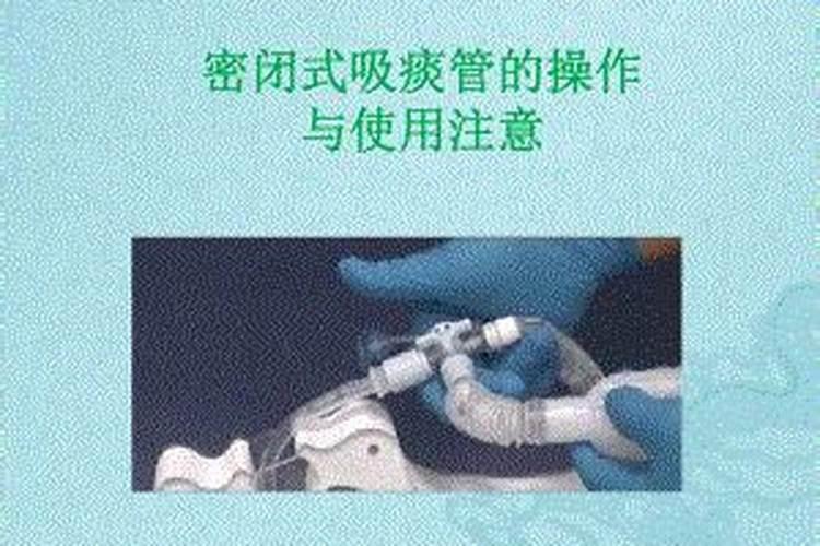 什么时候给油茶施肥最好？