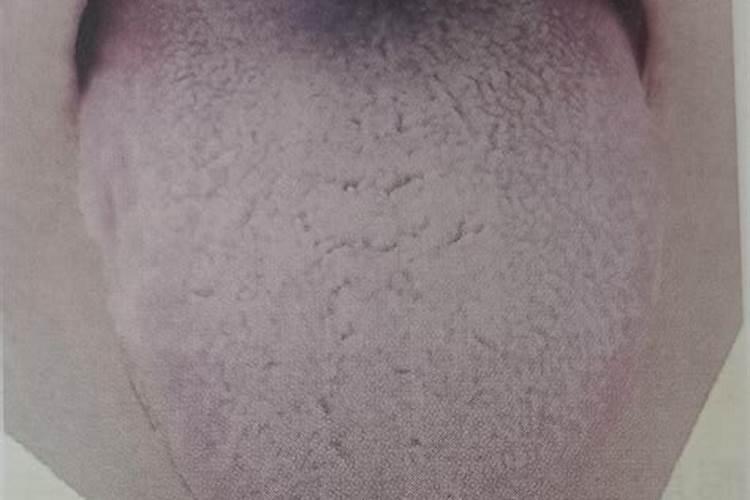 舌苔发黄厚腻是怎么回事