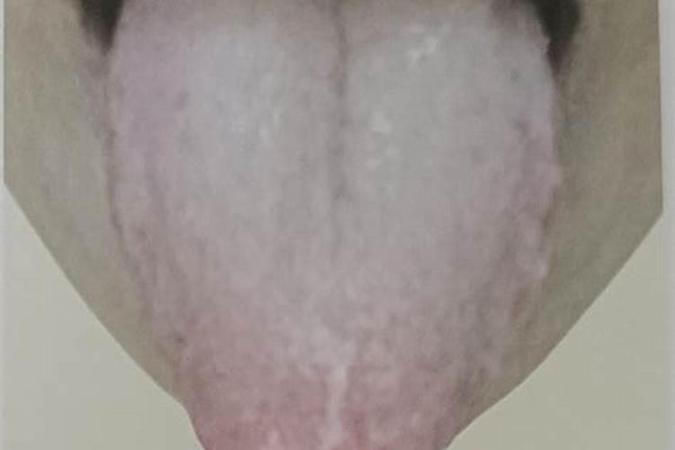 舌根部舌苔厚白原因