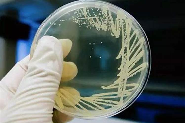 食用菌种植需要什么条件