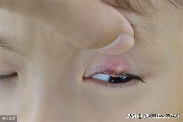 生菜叶片发黄可以喷施蔬菜叶面肥吗