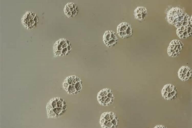 放线菌有什么作用？放线菌可以用于种植吗