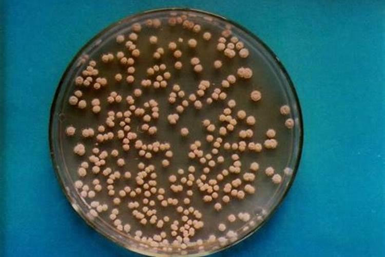 农用细黄链霉菌缺点