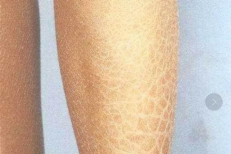 家庭怎样自制氮磷钾肥