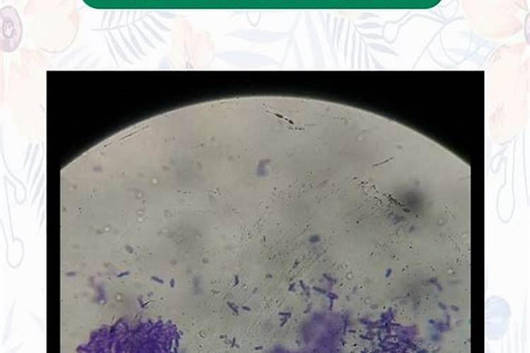 钾肥一亩地上多少